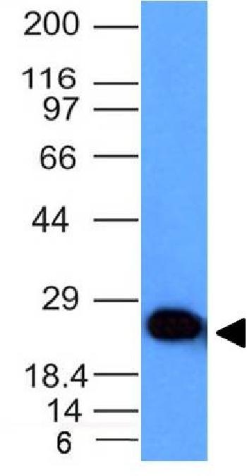 Anti-PGP9.5 / UchL1 (pan-Neuronal Marker) Monoclonal Antibody(Clone: UCHL1/841)