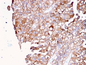 Anti-Uroplakin 1B (Urothelial Differentiation Marker) Monoclonal Antibody(Clone: UPK1B/3081)