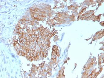 Anti-Uroplakin 1B (Urothelial Differentiation Marker) Monoclonal Antibody(Clone: UPK1B/3102)