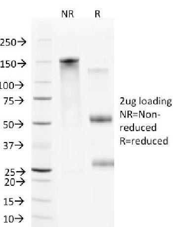 Anti-CD106 / VCAM1 (Activated Endothelial Cell Marker) Monoclonal Antibody(Clone: B-K9)