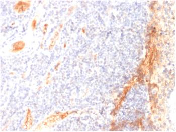 Anti-VEGF (Vascular Endothelial Growth Factor) Monoclonal Antibody(Clone: VG1)