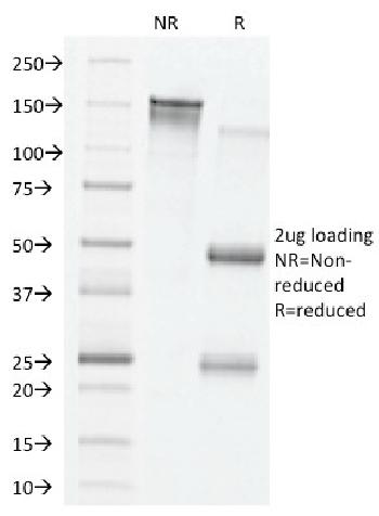 Anti-VEGF (Vascular Endothelial Growth Factor) Monoclonal Antibody(Clone: VG76e)