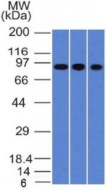 Anti-Villin (GI-Mucosal & Urogenital Brush Border Marker) Monoclonal Antibody(Clone: VIL1/1314)