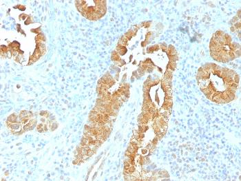 Anti-Villin (GI-Mucosal & Urogenital Brush Border Marker) Monoclonal Antibody(Clone: VIL1/1325)