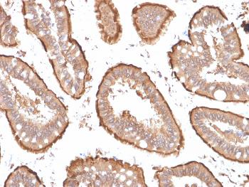 Anti-Villin (GI-Mucosal & Urogenital Brush Border Marker) Monoclonal Antibody(Clone: VIL1/1314 + VIL1/2376)