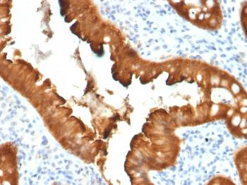 Anti-Villin (GI-Mucosal & Urogenital Brush Border Marker) Monoclonal Antibody(Clone: VIL1/2376)