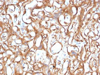 Anti-Ezrin / p81 Monoclonal Antibody(Clone: CPTC-Ezrin-1)