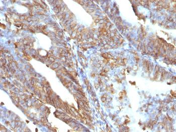 Anti-Vimentin (Mesenchymal Cell Marker) Monoclonal Antibody(Clone: V9)