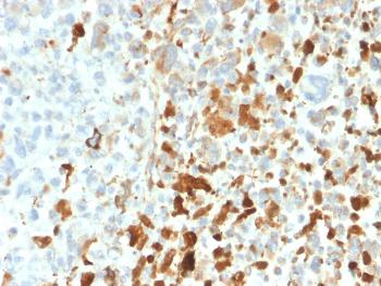 Anti-Vimentin (Mesenchymal Cell Marker) Monoclonal Antibody(Clone: VIM/1937R)