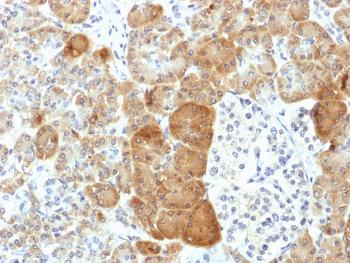 Anti-VLDL-Receptor (Very Low Density Lipoprotein Receptor) Monoclonal Antibody(Clone: VLDLR/1337)