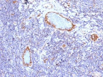 Anti-von Willebrand Factor / Factor VIII Related-Ag (Endothelial Marker) Monoclonal Antibody(Clone: VWF/1465)