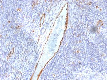 Anti-von Willebrand Factor / Factor VIII Related-Ag (Endothelial Marker) Monoclonal Antibody(Clone: F8/86)