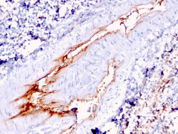 Anti-von Willebrand Factor / Factor VIII Related-Ag (Endothelial Marker) Monoclonal Antibody(Clone: VWF/1767)