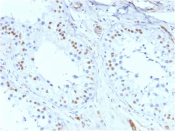 Anti-Wilm's Tumor 1 (WT1) (Wilm's Tumor & Mesothelial Marker) Monoclonal Antibody(Clone: rWT1/857)