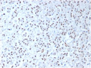 Anti-Wilm's Tumor 1 (WT1) (Wilm's Tumor & Mesothelial Marker) Monoclonal Antibody(Clone: WT1/1434R)