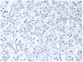 Anti-Wilm's Tumor 1 (WT1) (Wilm's Tumor & Mesothelial Marker) Polyclonal Antibody