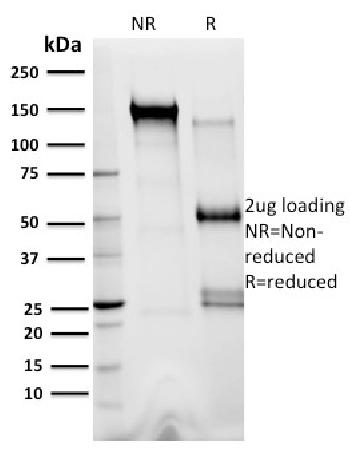 Anti-XRCC3 Monoclonal Antibody(Clone: 10F1/6)