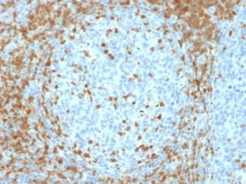 Anti-ZAP70 (Chronic Lymphocytic Leukemia Marker) Monoclonal Antibody(Clone: ZAP70/2035)