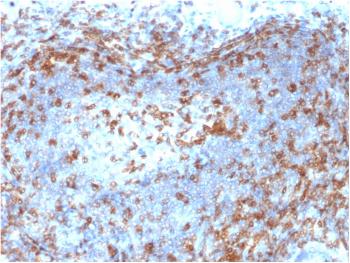 Anti-ZAP70 (Chronic Lymphocytic Leukemia Marker) Monoclonal Antibody(Clone: ZAP70/2046)