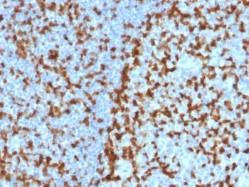 Anti-ZAP70 (Chronic Lymphocytic Leukemia Marker) Monoclonal Antibody(Clone: ZAP70/2047)