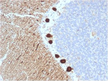 Anti-Carbonic Anhydrase VIII Monoclonal Antibody(Clone: CPTC-CA8-2)