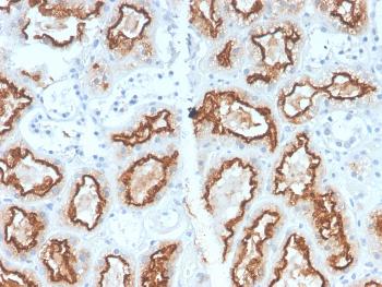 Anti-Renal Cell Carcinoma (Carbonic Anhydrase IX) Monoclonal Antibody(Clone: CA9/2993R)