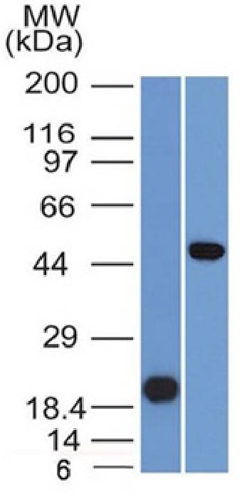 Anti-PAX8 (Renal Cell Marker) Monoclonal Antibody(Clone: PAX8/1491)