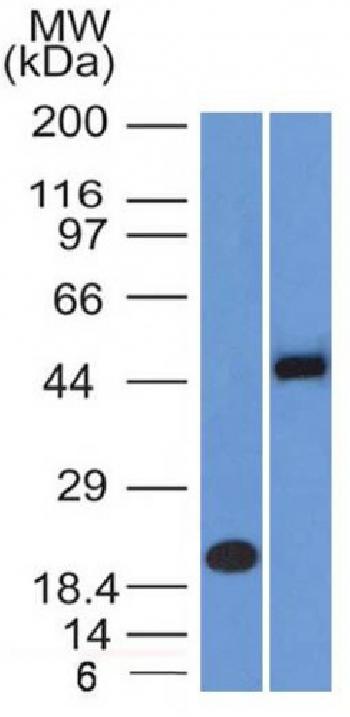 Anti-PAX8 (Renal Cell Marker) Monoclonal Antibody(Clone: PAX8/1492)