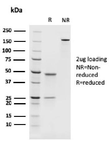 Anti-PAX8 (Renal Cell Marker) Monoclonal Antibody(Clone: rPAX8/1492)