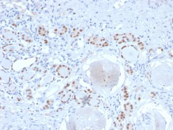 Anti-PAX8 (Renal Cell Marker) Monoclonal Antibody(Clone: PAX8/2774R)