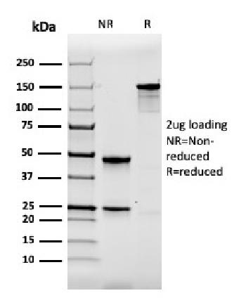 Anti-Calbindin 1 (CALB1) Monoclonal Antibody(Clone: CALB1/2364)