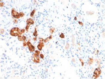 Anti-Calbindin 1 (CALB1) Monoclonal Antibody(Clone: CALB1/2782)