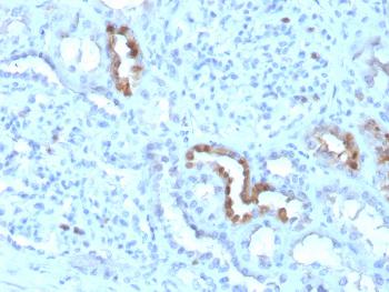 Anti-Calbindin 1 (CALB1) Monoclonal Antibody(Clone: CALB1/3333)