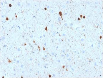 Anti-Calretinin / Calbindin 2 (Mesothelioma Marker) Monoclonal Antibody(Clone: CALB2/2602)