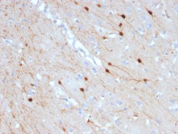 Anti-Calretinin / Calbindin 2 (Mesothelioma Marker) Monoclonal Antibody(Clone: CALB2/2685)