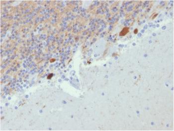 Anti-Calretinin / Calbindin 2 (Mesothelioma Marker) Monoclonal Antibody(Clone: CALB2/2807)