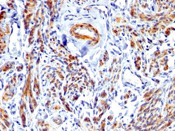 Anti-Caldesmon, HMW (h-Caldesmon) (Smooth Muscle Marker) Polyclonal Antibody