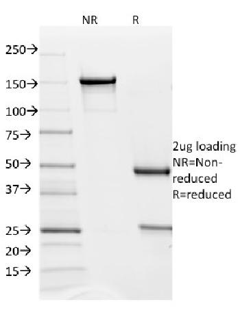 Anti-PD-L2 / PDCD1LG2 / CD273 Monoclonal Antibody(Clone: PDL2/1850)