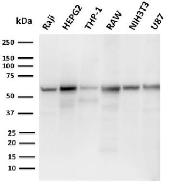 Anti-PD-L2 / PDCD1LG2 / CD273 Monoclonal Antibody(Clone: PDL2/2676)