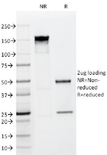 Anti-FGF23 (Fibroblast Growth Factor 23) Monoclonal Antibody(Clone: FGF23/638)