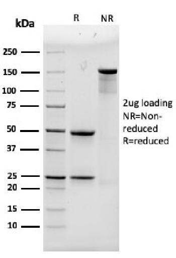 Anti-Alpha Actinin 4 / ACTN4 Monoclonal Antibody(Clone: 93)