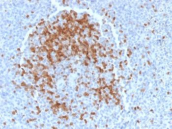 Anti-TCL1 (T-Cell Marker) Monoclonal Antibody(Clone: TCL1/2078)