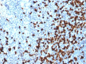 Anti-TCL1 (T-Cell Marker) Monoclonal Antibody(Clone: TCL1/2079)