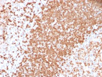 Anti-TCL1 (T-Cell Marker) Monoclonal Antibody(Clone: TCL1/2747R)