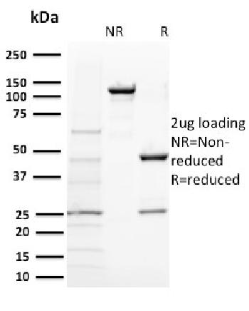 Anti-BAP1 (BRCA1 Associated Protein 1) Monoclonal Antibody(Clone: BAP1/2431)