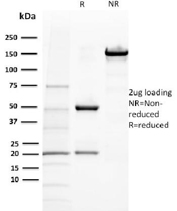 Anti-BAP1 (BRCA1 Associated Protein 1) Monoclonal Antibody(Clone: BAP1/2432)