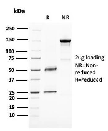 Anti-BAP1 (BRCA1 Associated Protein 1) Monoclonal Antibody(Clone: BAP1/2667)