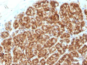 Anti-MAML2 (Mastermind Like Transcriptional Coactivator 2) Monoclonal Antibody(Clone: MAML2/1302)