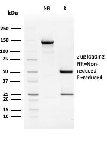 Anti-TIM3 / HAVCR2 / CD366 (Effector T-Cell Marker) Monoclonal Antibody(Clone: HAVCR2/192)