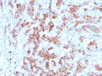 Anti-TIM3 / HAVCR2 / CD366 (Effector T-Cell Marker) Monoclonal Antibody(Clone: TIM3/3113)